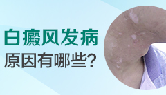 身身上出现一块一块的白斑是什么原因“脸上长白斑是怎么回事”诱发的原因有