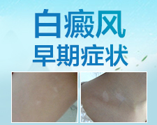 激光308做了十次没有效果怎么回事